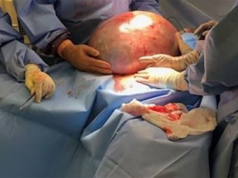 بالصور: لن تصدق ما استخرجه الأطباء من جسد هذه الفتاة!